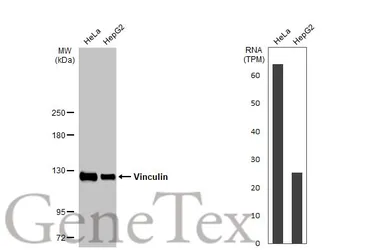 Anti-Vinculin antibody [HL1873] used in Western Blot (WB). GTX637622