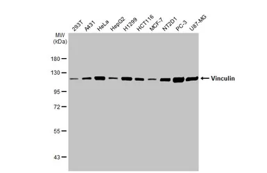 Anti-Vinculin antibody [HL1873] used in Western Blot (WB). GTX637622