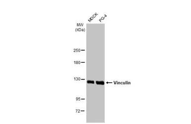 Anti-Vinculin antibody [HL1873] used in Western Blot (WB). GTX637622