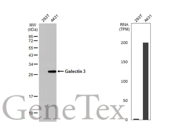 Anti-Galectin 3 antibody [HL1878] used in Western Blot (WB). GTX637627