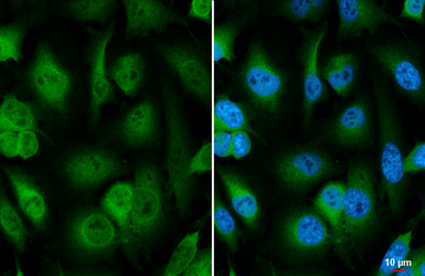 Anti-Galectin 3 antibody [HL1878] used in Immunocytochemistry/ Immunofluorescence (ICC/IF). GTX637627