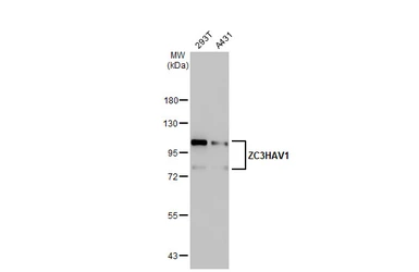 Anti-ZC3HAV1 antibody [HL1884] used in Western Blot (WB). GTX637633