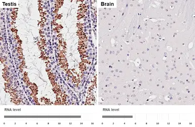 Anti-Ataxin 3 antibody [HL1909] used in IHC (Paraffin sections) (IHC-P). GTX637658
