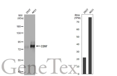 Anti-CD97 antibody [HL1925] used in Western Blot (WB). GTX637674