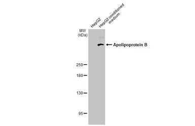 Anti-Apolipoprotein B antibody [HL1962] used in Western Blot (WB). GTX637799