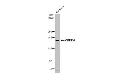 Anti-ORP150 antibody [HL2006] used in Western Blot (WB). GTX637907