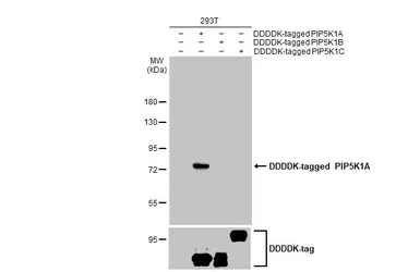 Anti-PIP5K1A antibody [HL2011] used in Western Blot (WB). GTX637912