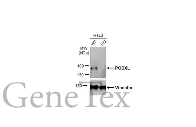 Anti-PODXL antibody [HL2047] used in Western Blot (WB). GTX637951