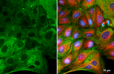 Anti-MX1 antibody [HL2051] used in Immunocytochemistry/ Immunofluorescence (ICC/IF). GTX637955