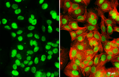Anti-KDM6A antibody [HL2068] used in Immunocytochemistry/ Immunofluorescence (ICC/IF). GTX637972