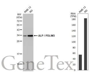 Anti-ALP / PDLIM3 antibody [HL2075] used in Western Blot (WB). GTX637983