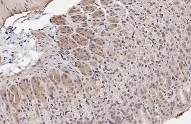 Anti-CDK6 antibody [HL2078] used in IHC (Paraffin sections) (IHC-P). GTX637986