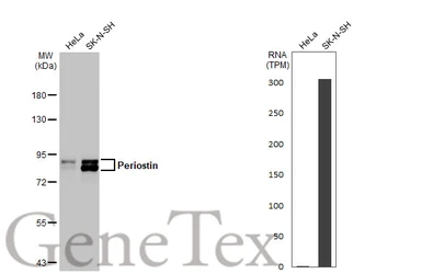 Anti-Periostin antibody [HL2112] used in Western Blot (WB). GTX638084