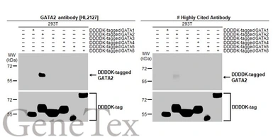 Anti-GATA2 antibody [HL2127] used in Western Blot (WB). GTX638099