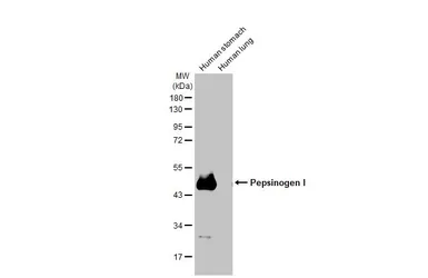 Anti-Pepsinogen I antibody [HL2137] used in Western Blot (WB). GTX638109