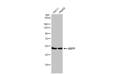 Anti-ADFP antibody [HL2145] used in Western Blot (WB). GTX638123