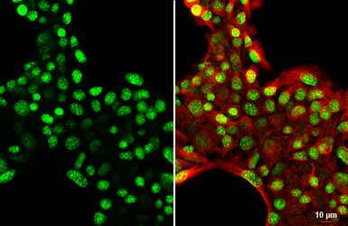 Anti-Histone H3K9me3 (Tri-methyl Lys9) antibody [HL2149] used in Immunocytochemistry/ Immunofluorescence (ICC/IF). GTX638127