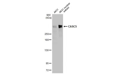 Anti-CASC5 antibody [HL2158] used in Western Blot (WB). GTX638136