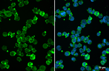 Anti-uPAR antibody [HL2169] used in Immunocytochemistry/ Immunofluorescence (ICC/IF). GTX638173