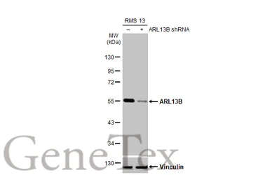 Anti-ARL13B antibody [HL2173] used in Western Blot (WB). GTX638177