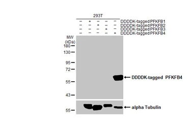 Anti-PFKFB4 antibody [HL2204] used in Western Blot (WB). GTX638208
