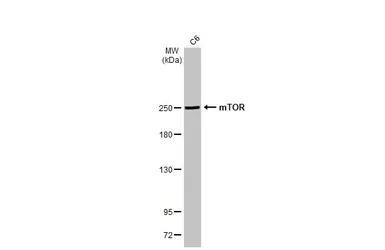 Anti-mTOR antibody [HL2216] used in Western Blot (WB). GTX638220