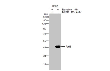 Anti-PAI2 antibody [HL2218] used in Western Blot (WB). GTX638222