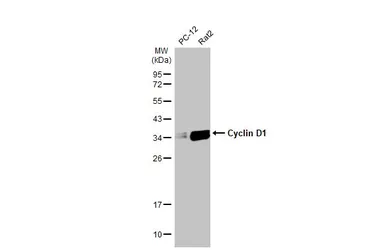 Anti-Cyclin D1 antibody [HL2219] used in Western Blot (WB). GTX638223