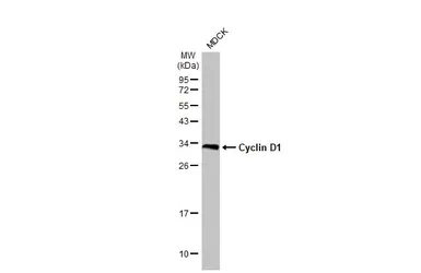Anti-Cyclin D1 antibody [HL2219] used in Western Blot (WB). GTX638223