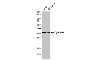 Anti-Cyclin D1 antibody [HL2219] used in Western Blot (WB). GTX638223