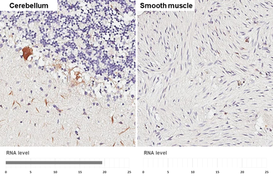 Anti-PKC gamma antibody [HL2226] used in IHC (Paraffin sections) (IHC-P). GTX638271