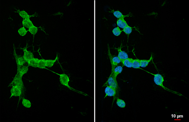 Anti-PKC gamma antibody [HL2227] used in Immunocytochemistry/ Immunofluorescence (ICC/IF). GTX638272