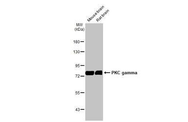 Anti-PKC gamma antibody [HL2227] used in Western Blot (WB). GTX638272