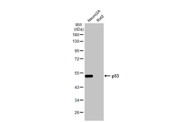 Anti-p53 antibody [HL2242] used in Western Blot (WB). GTX638291