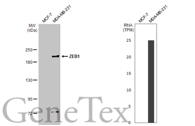 Anti-ZEB1 antibody [HL2245] used in Western Blot (WB). GTX638294