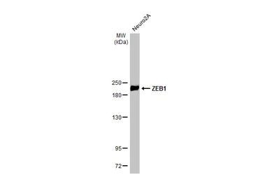 Anti-ZEB1 antibody [HL2245] used in Western Blot (WB). GTX638294