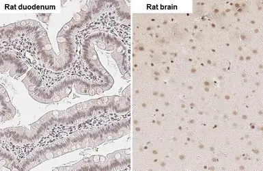 Anti-ZEB1 antibody [HL2245] used in IHC (Paraffin sections) (IHC-P). GTX638294