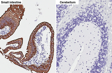 Anti-pan Cytokeratin antibody [HL2253] used in IHC (Paraffin sections) (IHC-P). GTX638302