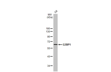 Anti-G3BP1 antibody [HL2254] used in Western Blot (WB). GTX638303