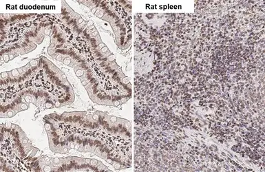 Anti-UHRF1 antibody [HL2287] used in IHC (Paraffin sections) (IHC-P). GTX638342
