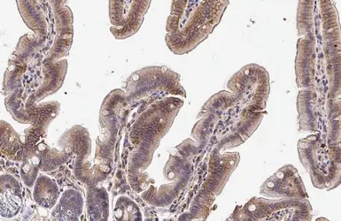 Anti-TLR3 antibody [HL2314] used in IHC (Paraffin sections) (IHC-P). GTX638477