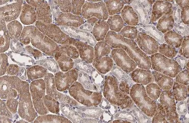 Anti-RNase L antibody [HL2340] used in IHC (Paraffin sections) (IHC-P). GTX638543