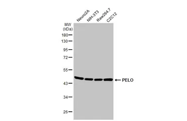 Anti-PELO antibody [HL2345] used in Western Blot (WB). GTX638548