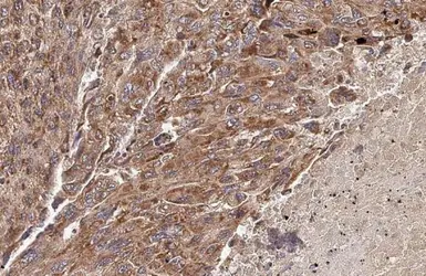 Anti-PELO antibody [HL2345] used in IHC (Paraffin sections) (IHC-P). GTX638548