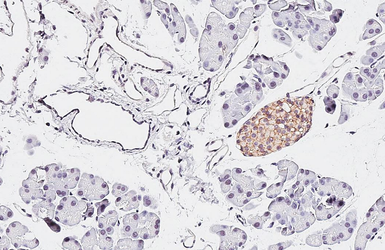 Anti-Calcium Sensing Receptor antibody [HL2357] used in IHC (Paraffin sections) (IHC-P). GTX638563