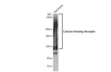 Anti-Calcium Sensing Receptor antibody [HL2357] used in Western Blot (WB). GTX638563