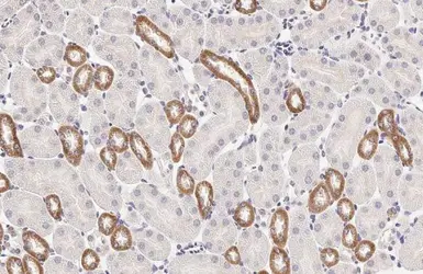 Anti-Calcium Sensing Receptor antibody [HL2357] used in IHC (Paraffin sections) (IHC-P). GTX638563