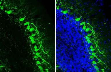Anti-Calbindin antibody [HL2378] used in IHC (Frozen sections) (IHC-Fr). GTX638586