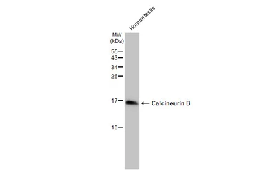 Anti-Calcineurin B antibody [HL2419] used in Western Blot (WB). GTX638641