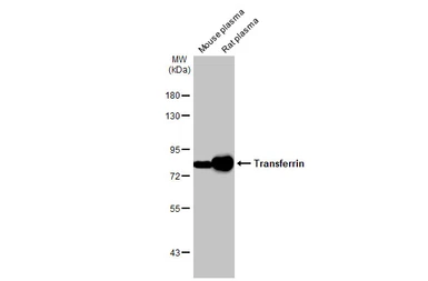 Anti-Transferrin antibody [HL2429] used in Western Blot (WB). GTX638745